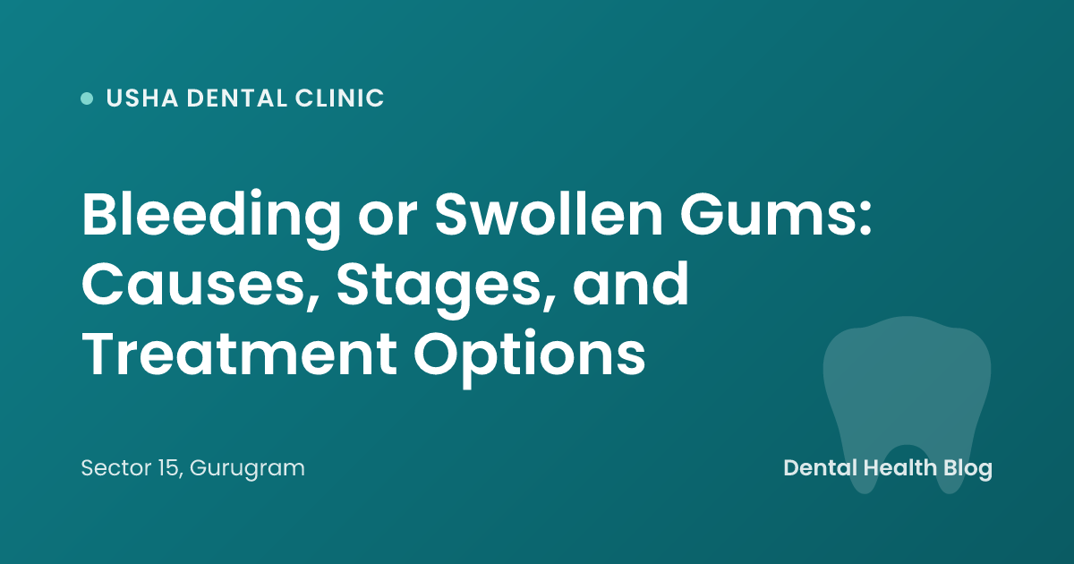 Bleeding or Swollen Gums: Causes, Stages, and Treatment Options