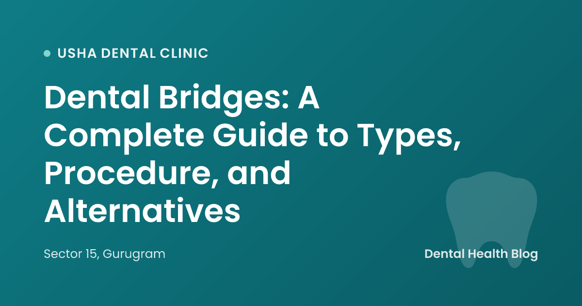 Dental Bridges: A Complete Guide to Types, Procedure, and Alternatives