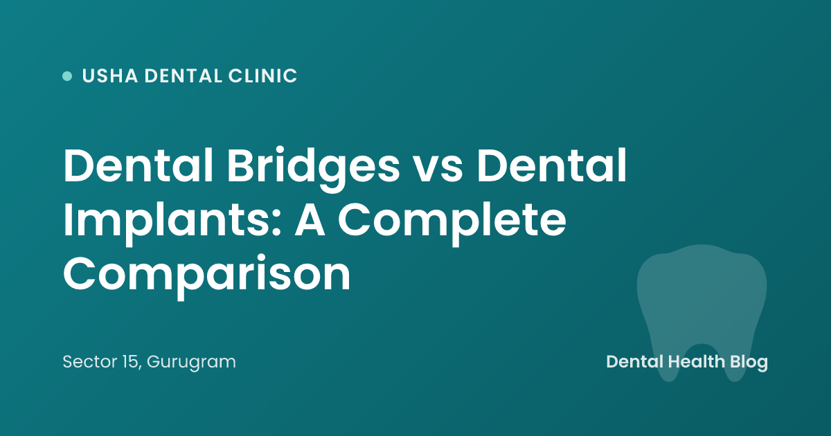 Dental Bridges vs Dental Implants: A Complete Comparison