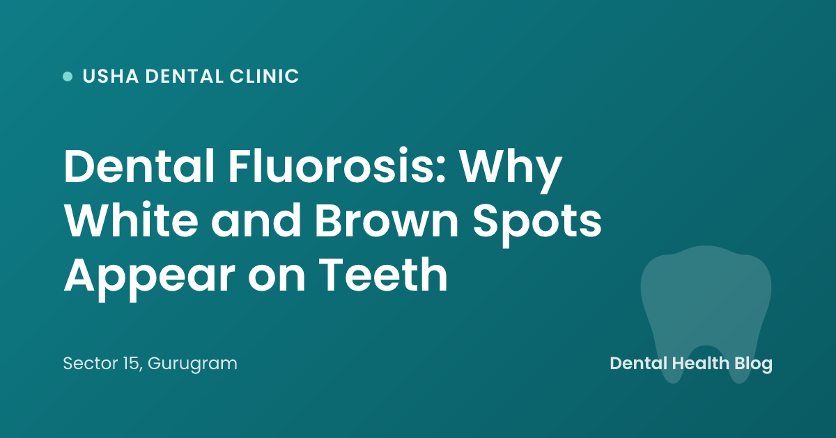 Dental Fluorosis: Why White and Brown Spots Appear on Teeth