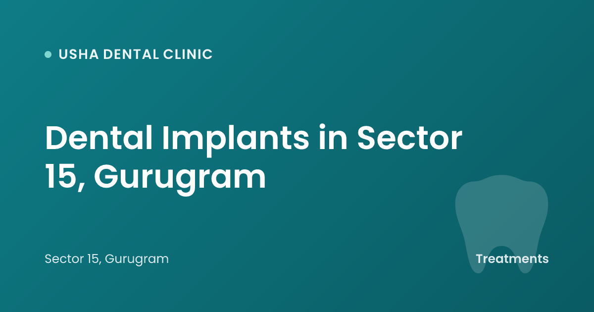 Dental Implants in Sector 15, Gurugram