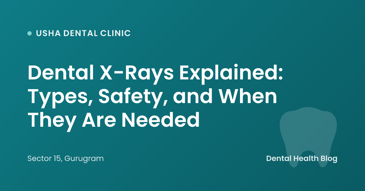 Dental X-Rays Explained: Types, Safety, and When They Are Needed