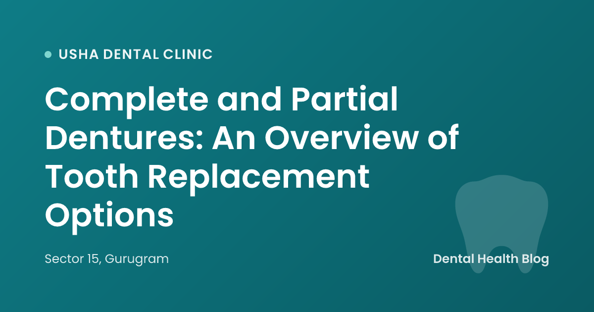 Complete and Partial Dentures: An Overview of Tooth Replacement Options