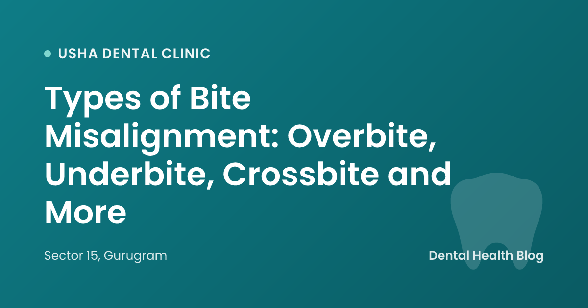 Types of Bite Misalignment: Overbite, Underbite, Crossbite and More