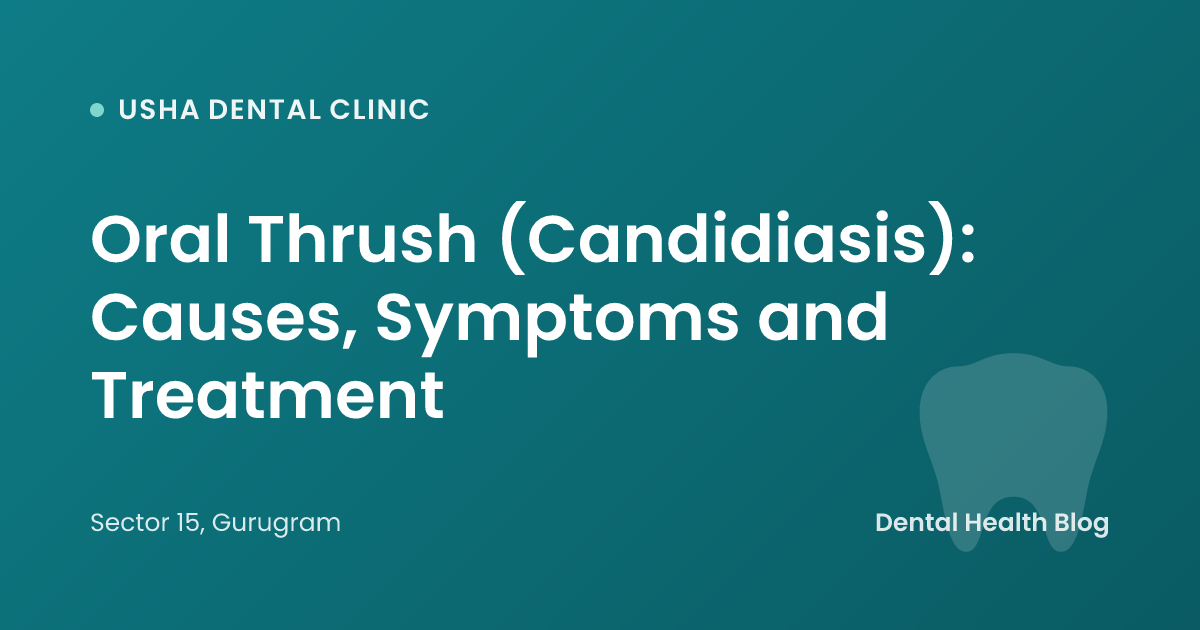 Oral Thrush (Candidiasis): Causes, Symptoms and Treatment