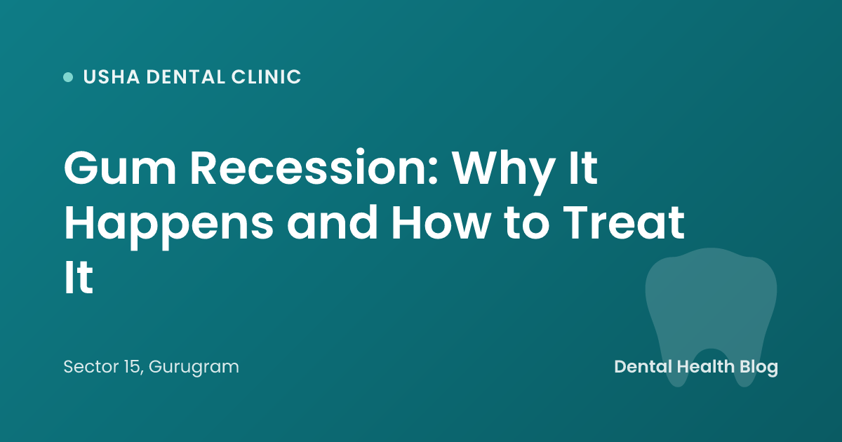 Gum Recession: Why It Happens and How to Treat It